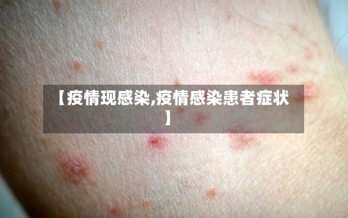 【疫情现感染,疫情感染患者症状】-第2张图片