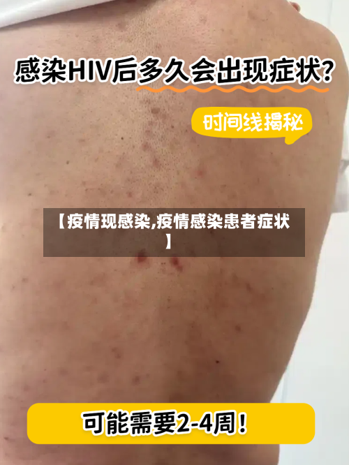 【疫情现感染,疫情感染患者症状】