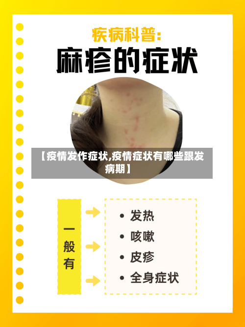 【疫情发作症状,疫情症状有哪些跟发病期】-第3张图片