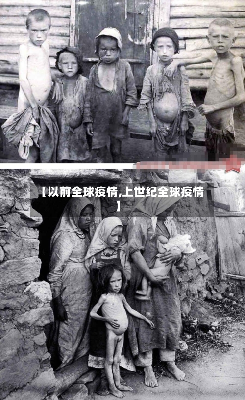 【以前全球疫情,上世纪全球疫情】