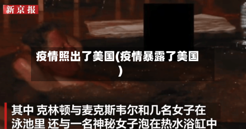 疫情照出了美国(疫情暴露了美国)-第2张图片