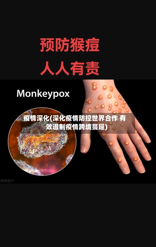 疫情深化(深化疫情防控世界合作 有效遏制疫情跨境蔓延)