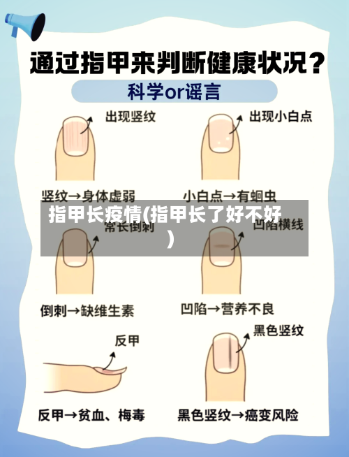 指甲长疫情(指甲长了好不好)