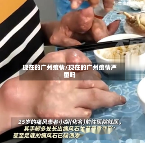 现在的广州疫情/现在的广州疫情严重吗
