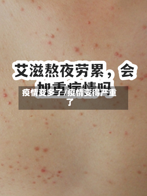 疫情变多了/疫情变得严重了